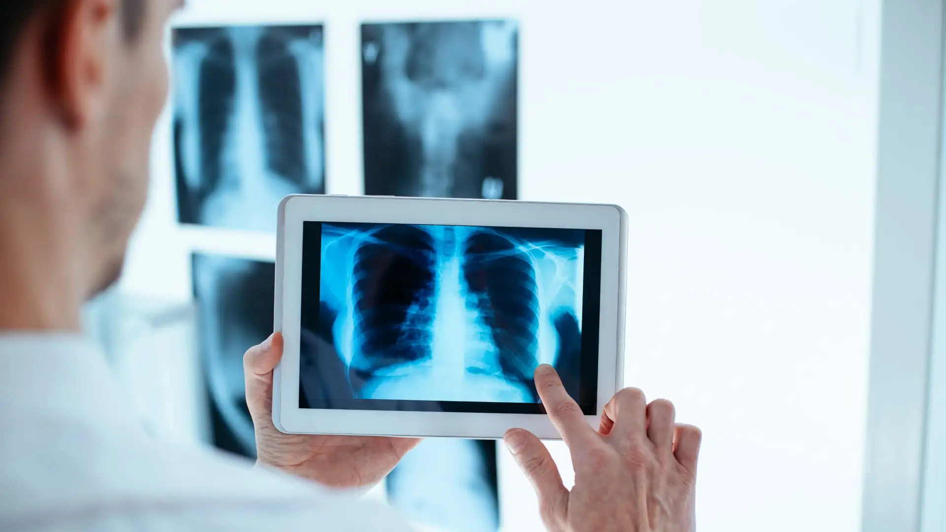 Es la fotografía de un radiólogo sosteniendo una tablet con una radiografía de tórax y de fondo estan impresas las radiografías.